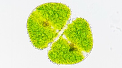 A green algae called Cosmarium. live specimen. 400x magnification.