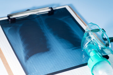 Oxygen Mask and Xray of lung