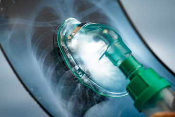 Oxygen Mask and Xray of lung - obrazy, fototapety, plakaty
