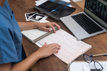 Attentive female doctor studies patient cardiogram sitting at table in office cardiologist analyzes...
