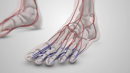 Diabetic blood vessel damage in the feet
