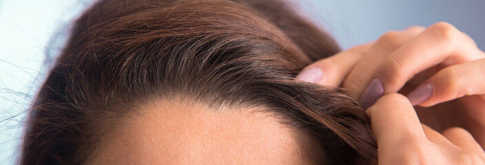 Obraz premium woman with hair problem