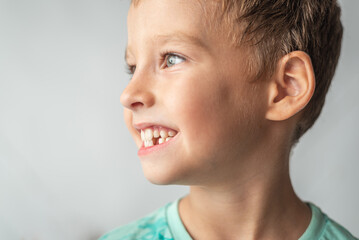 The child shows baby teeth. Pediatric dentistry and periodontology, bite correction. Health and...