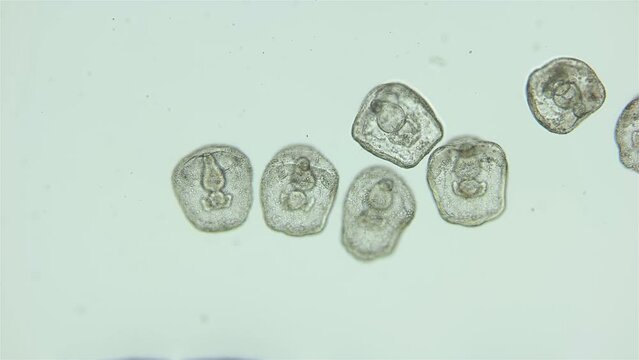 Larvae sea urchin Strongylocentrotus pallidus under microscope, phylum Echinodermata. Prism stage. White sea