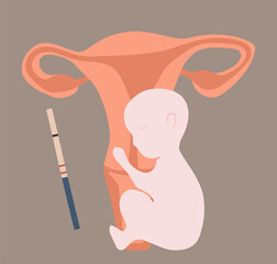 Vector isolated illustration of pregnancy. Trying to conceive. Health of a pregnant woman. Appointment with a gynecologist during pregnancy. Reproductive medicine.
