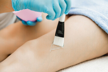 Before cavitation, the doctor applies the gel to the patient's legs. Anti-cellulite procedure....