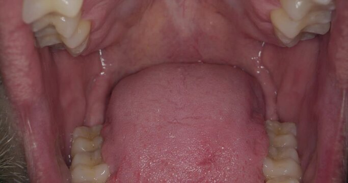 Untersuchung des Mundes beim Arzt