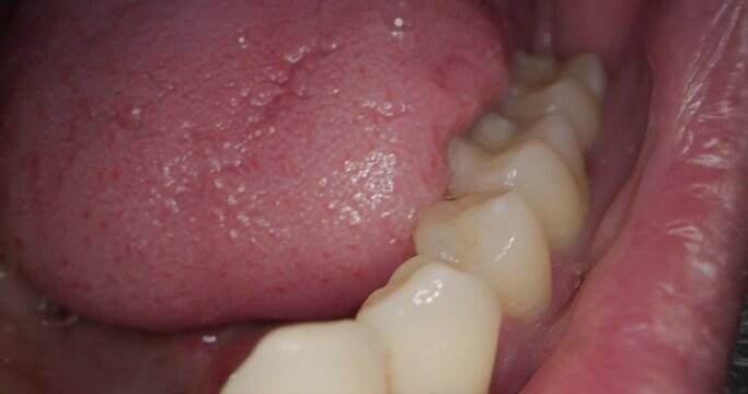 Untersuchung der unteren Zahnreihe beim Zahnarzt