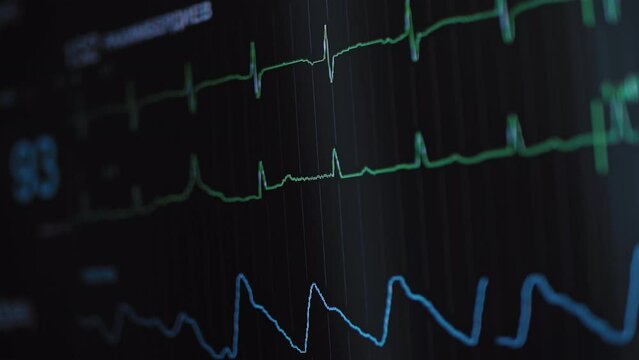 Hospital Vital Signs Tracking Monitor