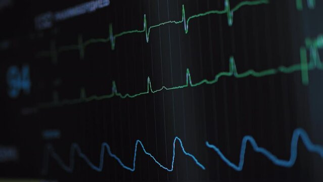 Hospital Vital Signs Tracking Monitor