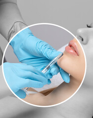 Cosmetologist does injections for lips augmentation and anti wrinkle in the nasolabial folds of a...