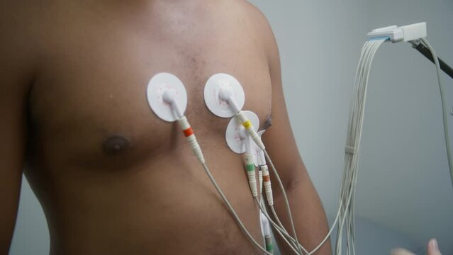 Female cardiologist puts sensors for holter monitoring on patient with heart disease. African American man during electrocardiography or heart rate measurement in cardiology room in medical center.