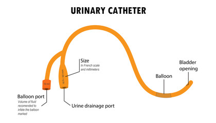 Urinary catheter diagram, how it is used, instructions - obrazy, fototapety, plakaty