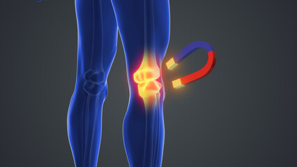 Magnet therapy for knee joint pain	
