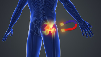 Magnet therapy for pelvis joint pain
