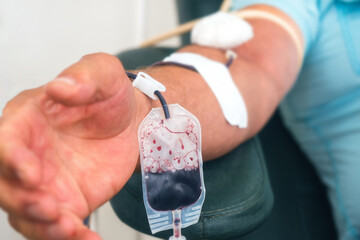 Donor sits in chair and donates blood from vein in medical clinic. Donor's hand with IV and needle...