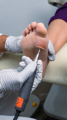 Foot treatment, Chiropody