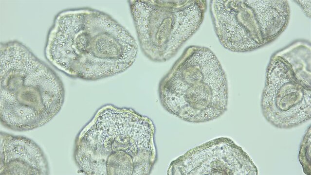 Larvae sea urchin Strongylocentrotus pallidus under microscope, phylum Echinodermata. Prism stage. White sea