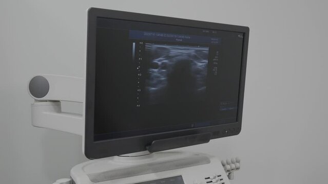 Ultrasound examination on a modern equipment in a medical center