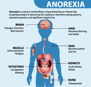 Effects of Anorexia on Male Anatomy