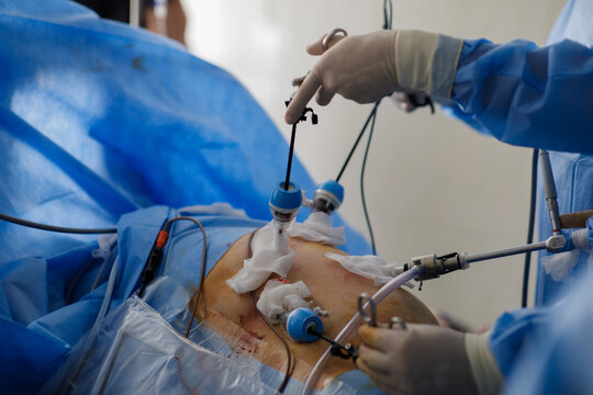doctors perform laparoscopy operations in the intensive care unit