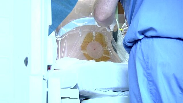 Pregnant Mother getting an Epidural before the delivery of a new baby in the hospital