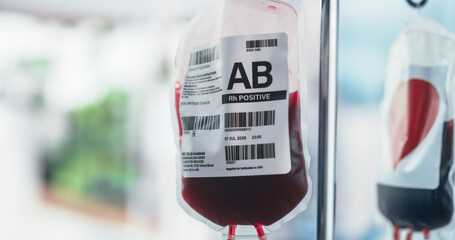Close Up Shot Of Two Blood Bags From Donor Hanging On The Stand In Donation Center Or Hospital. Concept Of Saving Lives of Patients Who Require Blood Transfusion After Organ Transplantation.