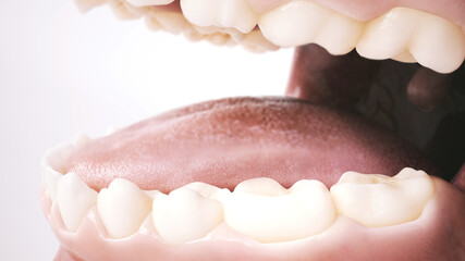Third Step to the Perfect Smile: Filling the Gap with an Implant. Part 3. 3D Rendering