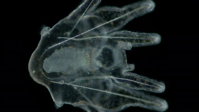 Larva sea urchin Strongylocentrotus pallidus under microscope, phylum Echinodermata. Arm pluteus stagee. White sea