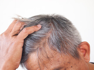 Fototapeta premium Closeup gray white color hair problem in senior asian man.