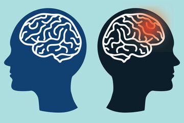sick brain vs healthy brain - obrazy, fototapety, plakaty