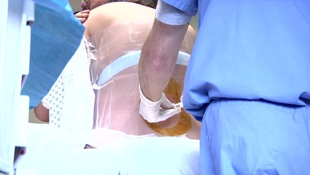 Male nurse giving epidural injection before surgery