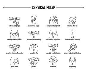 Cervical Polyp symptoms, diagnostic and treatment vector icons. Line editable medical icons.