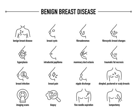 Benign Breast Disease symptoms, diagnostic and treatment vector icons. Line editable medical icons.