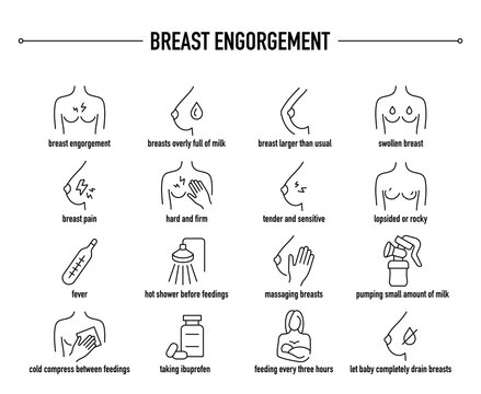 Breast Engorgement symptoms, diagnostic and treatment vector icons. Line editable medical icons.