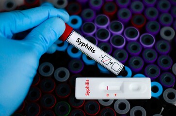 The patient negative for syphilis by rapid diagnostic test.