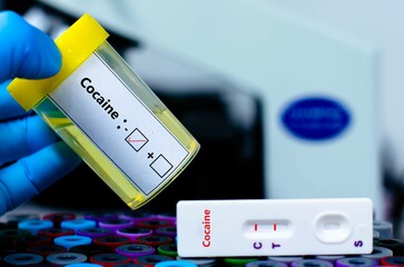 Urine sample of patient negative for cocaine by rapid diagnostic test.
