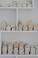 Gypsum models of teeth jaws lie on a white shelf against a white wall background. Patient numbers...