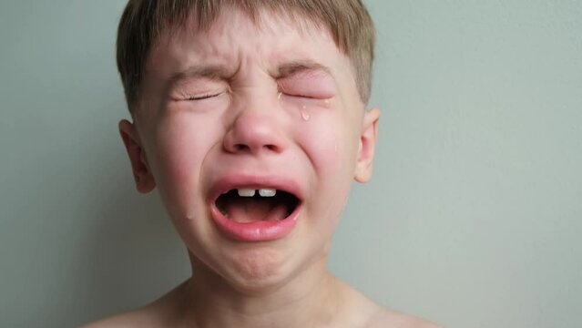 Dramatic portrait of a crying 7 year old boy. Tears flow from the eyes. The upset child. A swollen eye hurts due to a blow or insect bite. Sorrow. Children violence. Stress concept. Kids hysteria. 4K.