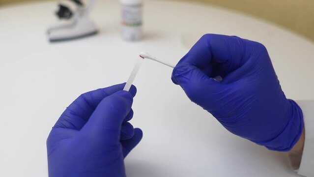 Bacterial Vaginosis. Vaginal pH. Diagnostic. Scale by which you can measure whether acidity normal or not. Normal acidity level shown in colors and must be compared with standard. Laboratory and home