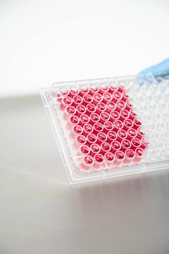 Closeup of a plastic container with liquid medicine in a lab