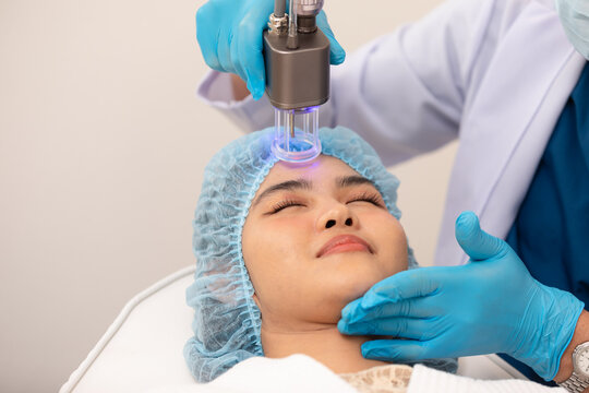 Doctor using CO2 Laser to treat skin conditions of patient.  Innovative dermatological procedure for skin rejuvenation and therapy. Aesthetics Skin Care Concept