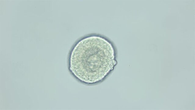 Larva sea urchin Strongylocentrotus pallidus under microscope, phylum Echinodermata. Blastula stage, locking half. White sea