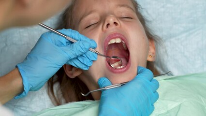 Dentist examining the child teeth, close-up