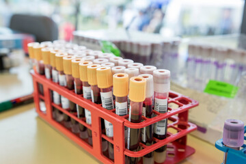 Próbówki z krwią do badania stojące na stole - obrazy, fototapety, plakaty