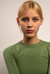 photo of a beautiful girl 18 years old with blond hair and acne on a light background