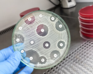 Antimicrobial susceptibility testing in culture plate. Drug sensitivity test, disk drug, antibiotic...