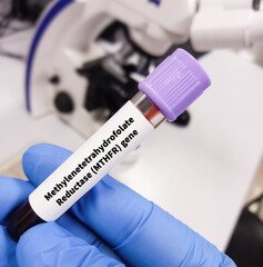 Blood sample for Methylenetetrahydrofolate Reductase (MTHFR) variant or MTHFR mutation test, to Hyperhomocysteinemia.