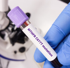Blood sample for Methylenetetrahydrofolate Reductase (MTHFR) variant or MTHFR mutation test, to...