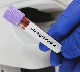 Blood sample for Methylenetetrahydrofolate Reductase (MTHFR) variant or MTHFR mutation test, to Hyperhomocysteinemia.